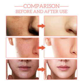 Anti-wrinkle Vitamin C&E